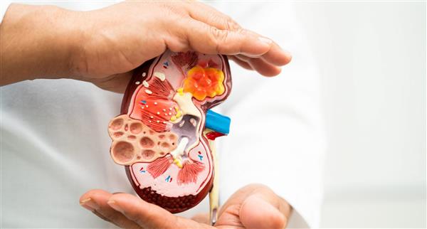 Diagram of a kidney