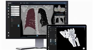 Singular Health launches upgraded DICOM viewer, with patient-friendly features for engagement with medical records