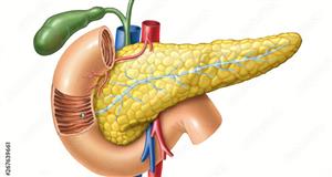 OncoSil doses first patient with OncoSilTM to advance pancreatic cancer treatment trials