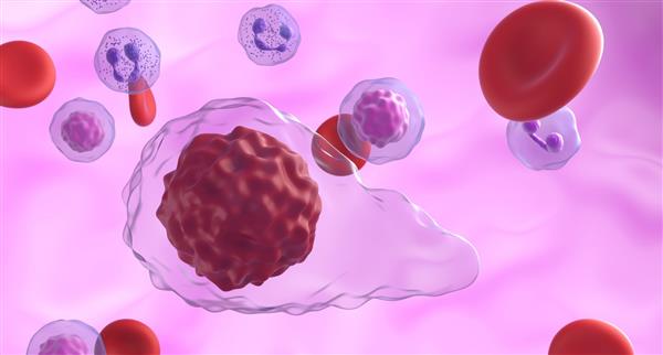 Myelofibrosis cells in blood flow