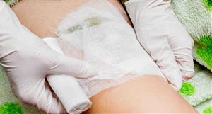 Avita boosts skin restoration product portfolio with 'dermal matrix' – a kind of next-level gauze made of fake skin