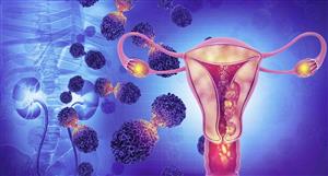 Inoviq closes the gap on blood test results for ovarian cancer