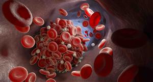 Universal Biosensors flat despite fresh deal with US medical product distributor