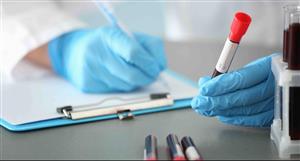 CLEO Diagnostics kicks off ovarian cancer-detecting blood test trials in USA