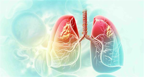 Lung imaging concept