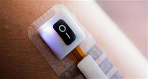Control Bionics obtains FDA registration and device listing for NeuroStrip