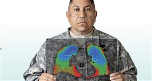 4DMedical partners with West Los Angeles VA Medical Center for Veteran lung imaging study