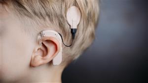 Cochlear upgrades FY24 earnings guidance as shares surge 5pc
