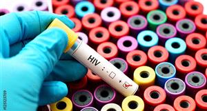 Atomo Diagnostics orders HIV self-test kits for third world countries