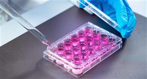 Up over +30% the last month, Mesoblast's darling status could be on cusp of return